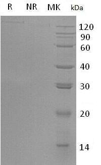 Human LDLR (His/AVI tag) recombinant protein