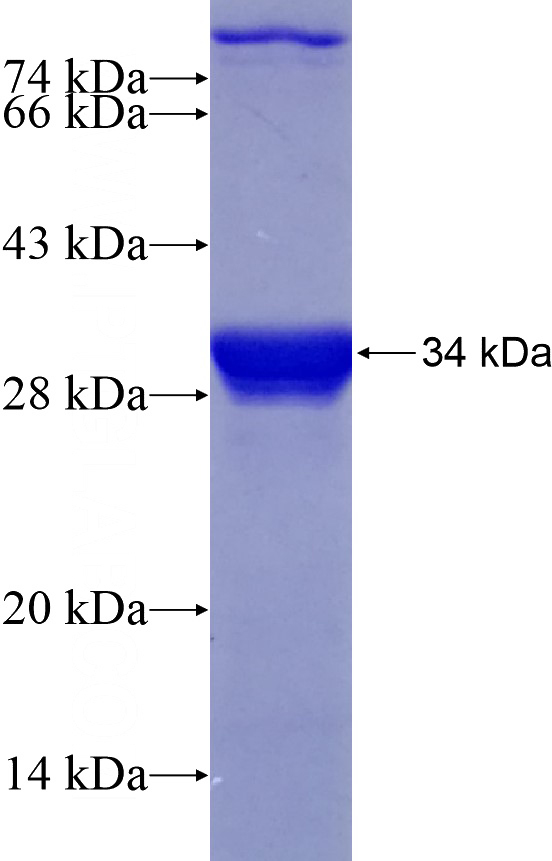 Recombinant Human CCDC171 SDS-PAGE