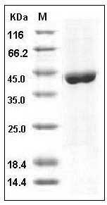 Human ACY1 / Aminoacylase-1 Protein (His Tag) SDS-PAGE