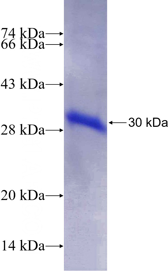 Recombinant Human SH3RF2 SDS-PAGE