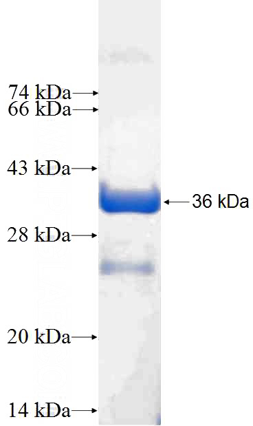 Recombinant Human SH3BGRL3 SDS-PAGE