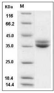 Human GPA33 / Glycoprotein-A33 Protein (His Tag) SDS-PAGE
