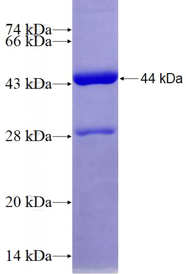 Recombinant Human IDH2 SDS-PAGE