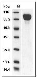Mouse IL6ST / gp130 / CD130 Protein (His Tag) SDS-PAGE