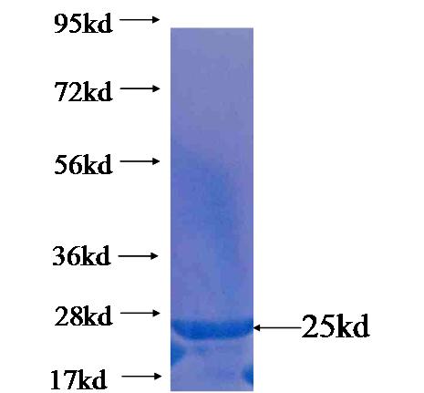 Recombinant human LPPR4 SDS-PAGE