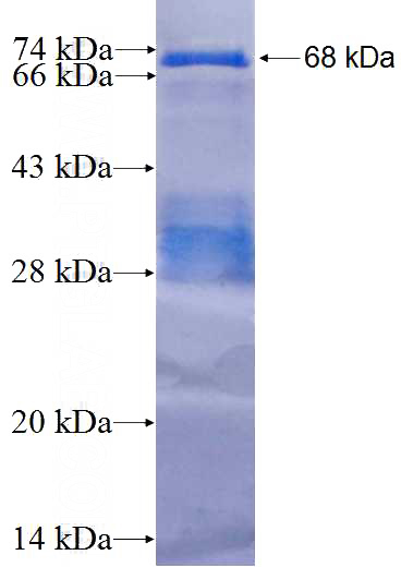 Recombinant Human NCAPH SDS-PAGE
