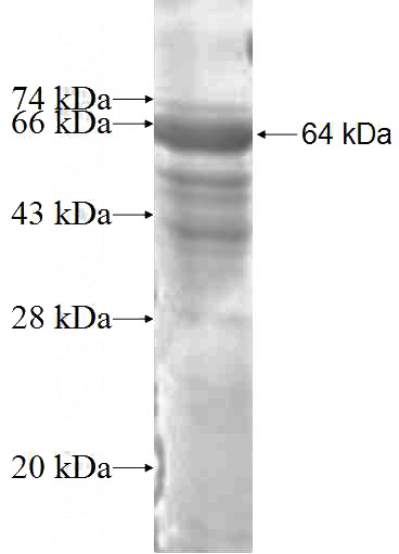 Recombinant Human UBOX5 SDS-PAGE