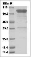 Human LAG3 / CD223 / Lymphocyte activation gene 3 Protein (Fc Tag)