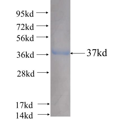 Recombinant human HCCS(Full length) SDS-PAGE