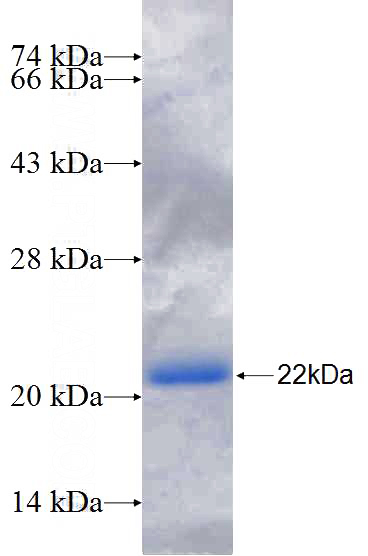 Recombinant Human AHNAK2 SDS-PAGE