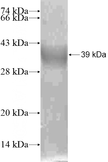 Recombinant Human SGK493 SDS-PAGE