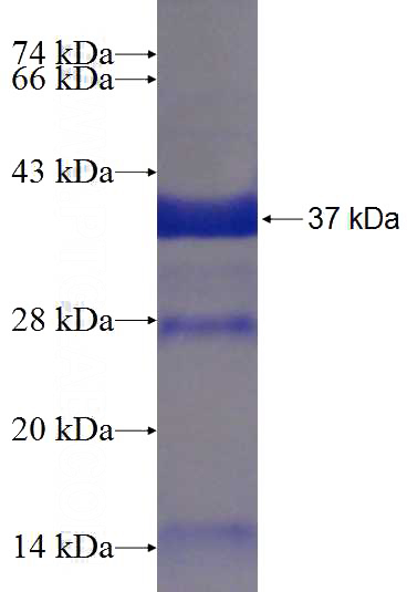 Recombinant Human Porin SDS-PAGE
