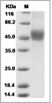 Mouse CD122 / IL2RB / IL2 Receptor beta Protein (His Tag) SDS-PAGE