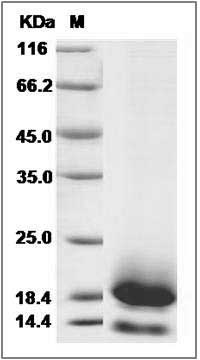 Cynomolgus CD59 / CD59A / MAC-IP Protein (His Tag) SDS-PAGE