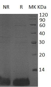Human DEFB4A/DEFB102/DEFB2/DEFB4/DEFB4B recombinant protein