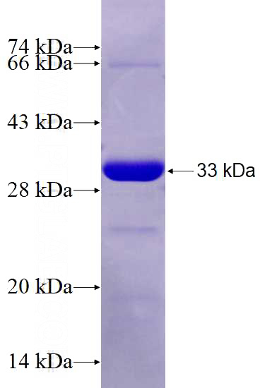 Recombinant Human IRAK2 SDS-PAGE
