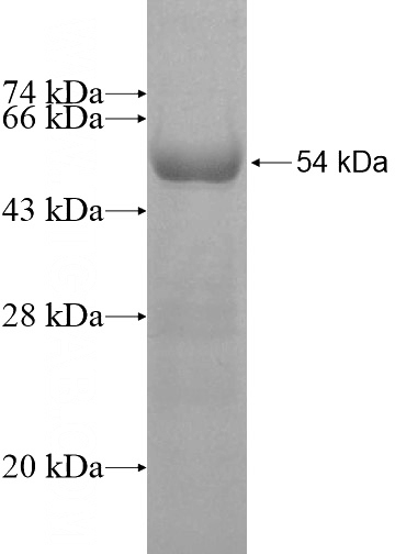 Recombinant Human MTRF1L SDS-PAGE