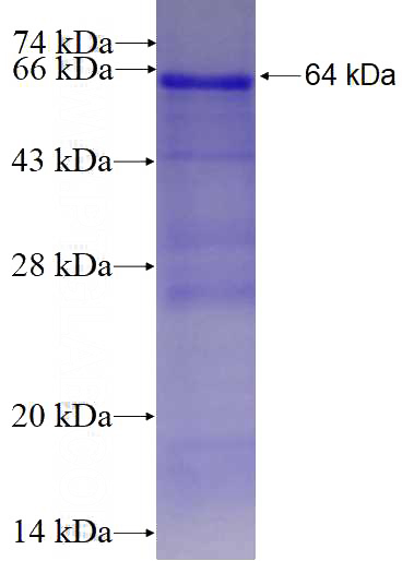 Recombinant Human RHPN1 SDS-PAGE