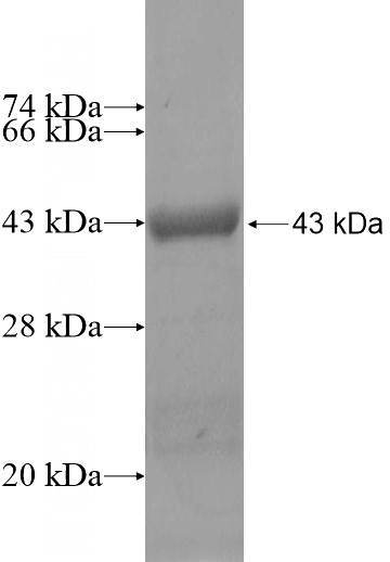 Recombinant Human ANKRD10 SDS-PAGE