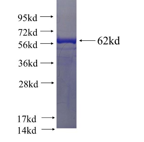 Recombinant human RBBP5 SDS-PAGE