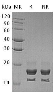 Human TNFSF18/AITRL/GITRL/TL6 (His tag) recombinant protein