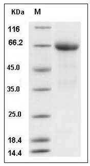 Human Angiopoietin 4 / ANG4 / ANGPT4 Protein (Fc Tag) SDS-PAGE