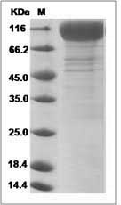 Human Interleukin-31 receptor A / IL31RA Protein (His Tag)