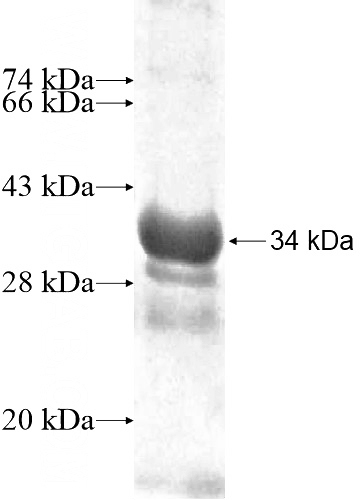 Recombinant Human ZNF3 SDS-PAGE
