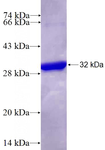 Recombinant Human CRYBB1 SDS-PAGE