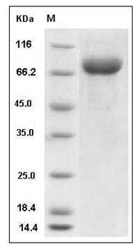 Mouse LILRB3 / LIR3 / ILT5 / CD85a Protein (His Tag) SDS-PAGE