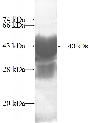 Recombinant Human MYL1 SDS-PAGE