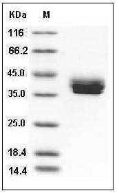 Mouse CADM3 / NECL1 / IGSF4B Protein (His Tag) SDS-PAGE