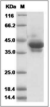 Human PTH / PTH1 / Parathyroid Hormone Protein (Fc Tag) SDS-PAGE