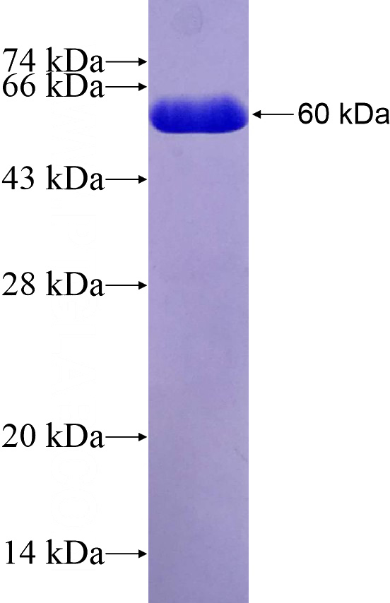 Recombinant Human SLC24A1 SDS-PAGE