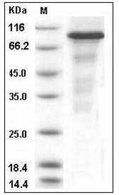 Human ERN1 / IRE1 Protein (aa 465-977, His & GST Tag) SDS-PAGE