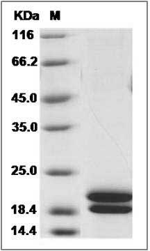 Cynomolgus REG1A / PSPS Protein (His Tag) SDS-PAGE