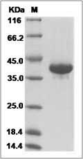 Human Resistin / ADSF / RETN Protein (Fc Tag)