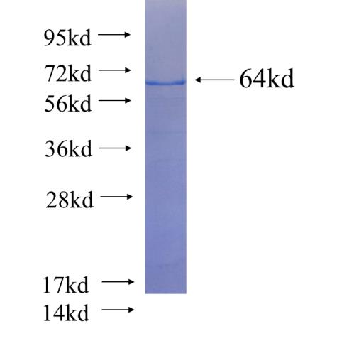 Recombinant human ACCS SDS-PAGE