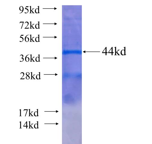 Recombinant human DGKQ SDS-PAGE