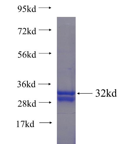 Recombinant human HOXB2 SDS-PAGE