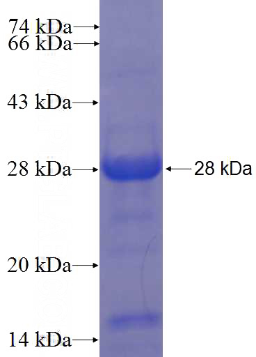 Recombinant Human CITED1 SDS-PAGE