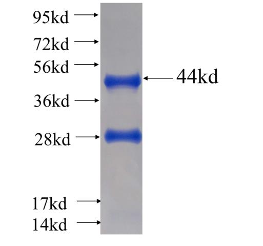 Recombinant human CBP20 SDS-PAGE