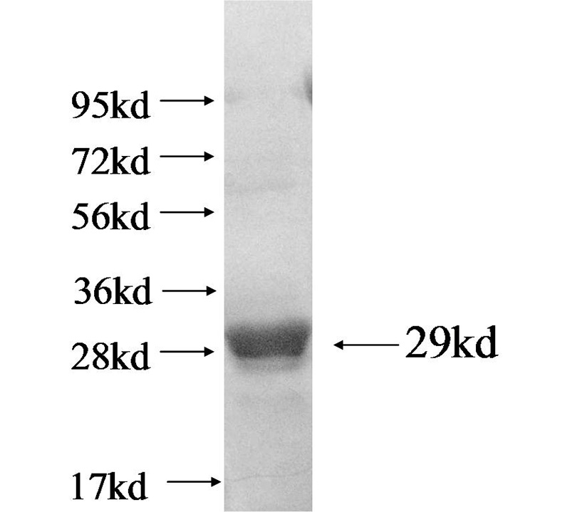 Recombinant human MRPL21(Full length) SDS-PAGE