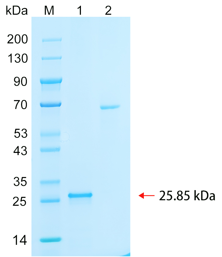 Recombinant SPIN4 protein (His tag) SDS-PAGE