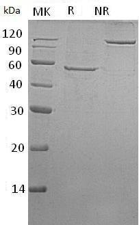 Mouse Dkk1 (His tag) recombinant protein