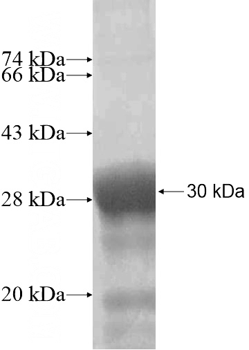 Recombinant Human RNF32 SDS-PAGE