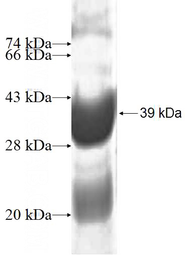 Recombinant Human NDUFA5 SDS-PAGE