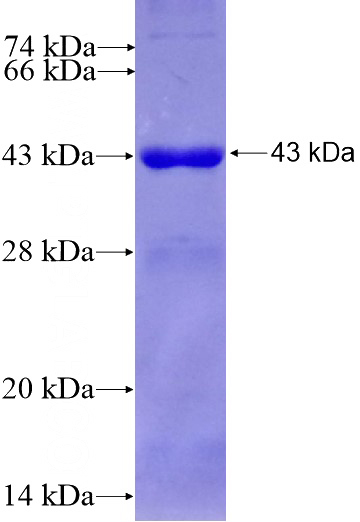 Recombinant Human CLPB SDS-PAGE