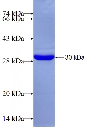 Recombinant Human BZRAP1 SDS-PAGE