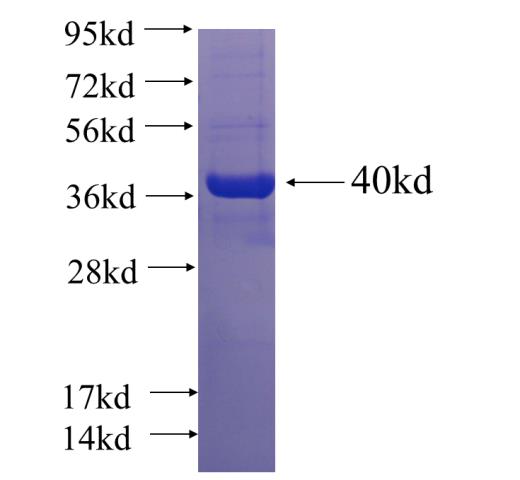 Recombinant human EPB41L3 SDS-PAGE